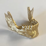1 of 1 GOLD JAW$